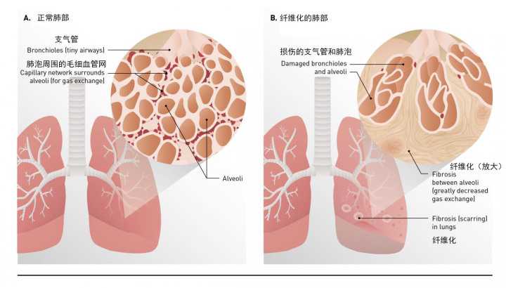 悦刻影响性功能吗?从香烟的影响来推测