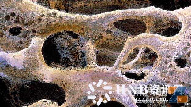 电子烟在悄悄伤害你的骨健康